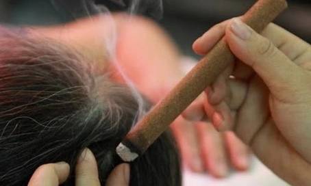 Chữa bệnh bằng phương pháp “Cứu” trong y học cổ truyền